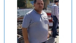 تصاویر قبل و بعد از عمل چاقی