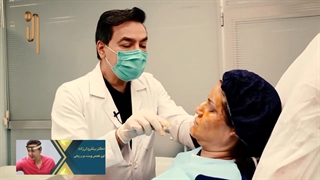 زاویه سازی و لیفت صورت با تزریق چربی، نانوفت و (svf)