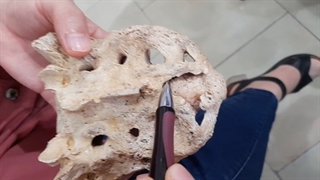 استخوان ساکروم . عملی. پزشکی