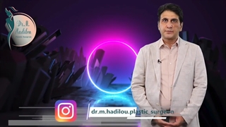 ماموپلاستی چیست؟