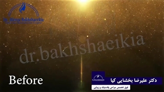 جراحی زیبایی بینی