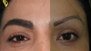 انجام کاشت ابرو بر روی ابروهای تتو شده