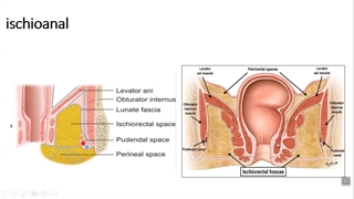 حفره ایسکیورکتال . پزشکی