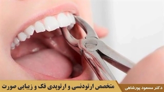 آیا برای ارتودنسی کشیدن دندان لازم است؟