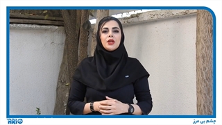 ویژگی های مهم چشمی دزدگیر اماکن وزنی بیرونی