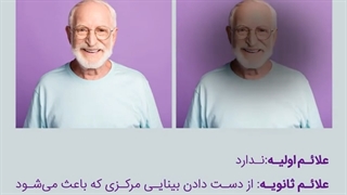 هر آنچه که باید در مورد بیماری ماکولای چشم بدانید! | سوپرابیون