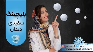 هر آنچه درباره بلیچینگ دندان باید بدانید!