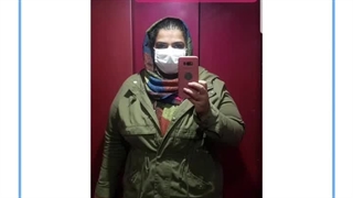 تصاویر قبل و بعد از عمل چاقی