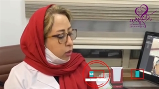 موضوع: بارداری با اولین iui در بیمار با سابقه نازایی اولیه