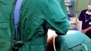 فیلم واقعی لیپوساکشن شکم و پهلو