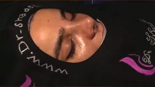 بلافاصله بعد از جراحی بینی با وجود تورم فراوان