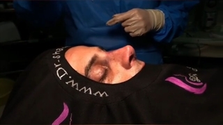 جراحی بینی مردانه