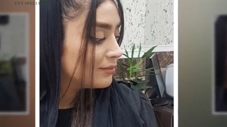 جراحی بینی به سبک نچرال استتیک