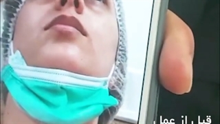 جراحی زیبایی بینی