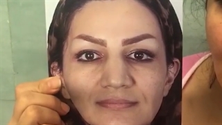 جراحی زیبایی بینی