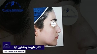 جراحی زیبایی بینی