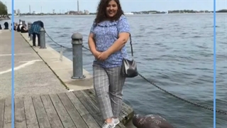 تصاویر قبل و بعد از عمل چاقی