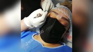 کاشت مو در کلینیک جوان بوکان