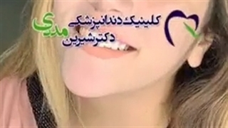 8 واحد لمینیت سرامیکی ایمکس بدون تراش