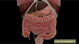 جراحی بای پس معده  چگونه انجام می شود؟