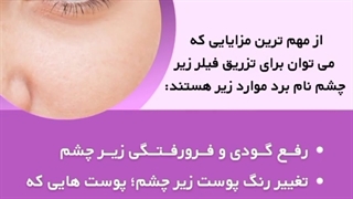 رفع تیرگی زیر چشم با فیلر