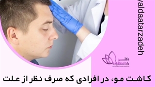 کاشت مو