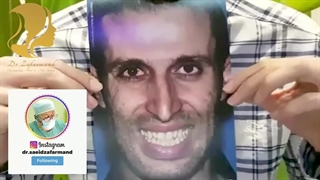 رضایت جراحی بینی  توسط دکتر سعید ظفرمند