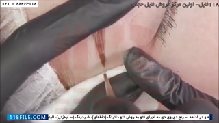 الگوی خطوط میکروبلیدینگ