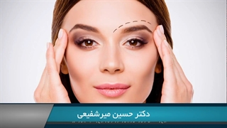 لیفت ابرو