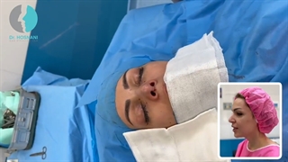 جراحی بینی مراجعه کننده از عمان