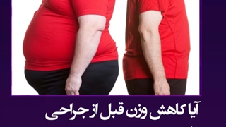 کاهش وزن قبل از جراحی ژنیکوماستی