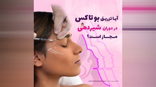 آیا بوتاکس در دوران شیر دهی مجاز است؟