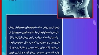 جراحی تومور های هیپوفیز از راه بینی