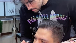 رفع گودی زیر چشم09126074167