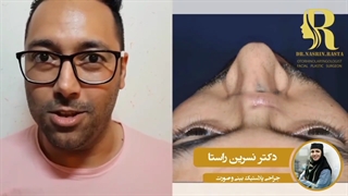 تغییـرات زییای جوی عزیز بعد از گذشت چندسال