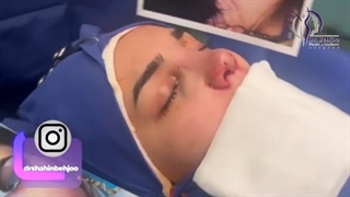 جراحی زیبایی بینی