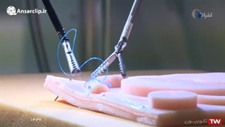 جراحی رباتیک از راه دور - ساخت ایران