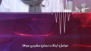عوامل ابتلا و درمان سفیدی مو