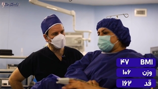 آیا میتوان با عمل اسلیو معده دیابت را درمان کرد؟