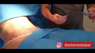 فیلم واقعی جراحی تامی تاک