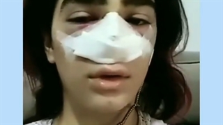 نمونه رضایت بیمار از عمل بینی