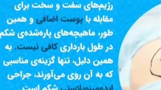 ابدومینو پلاستی قبل یا بعد از زایمان