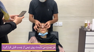 انجام معاینه بعد از جراحی بینی و آموزش نحوه چسب زدن
