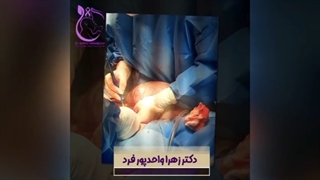 خروج توده ۲۵ سانتی از شکم خانم جوان