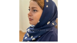 جراحی بینی فانتزی