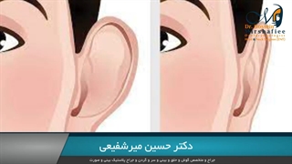 جراحی زیبایی گوش