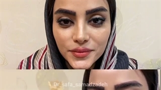 جراحی زیبایی بینی