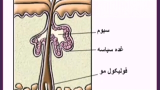 راهکار های خانگی و دارویی درمان چربی پوست لیپوست