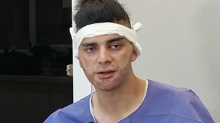 بلافاصله بعد از کاشت ریش و سبیل