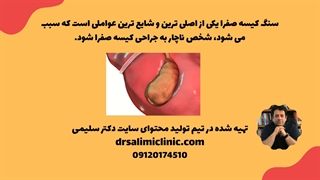 عمل کیسه صفرا با لیزر
